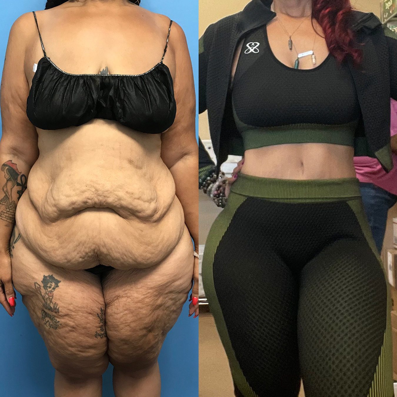 Dr. Cat Plastic Surgery Beverly Hills
