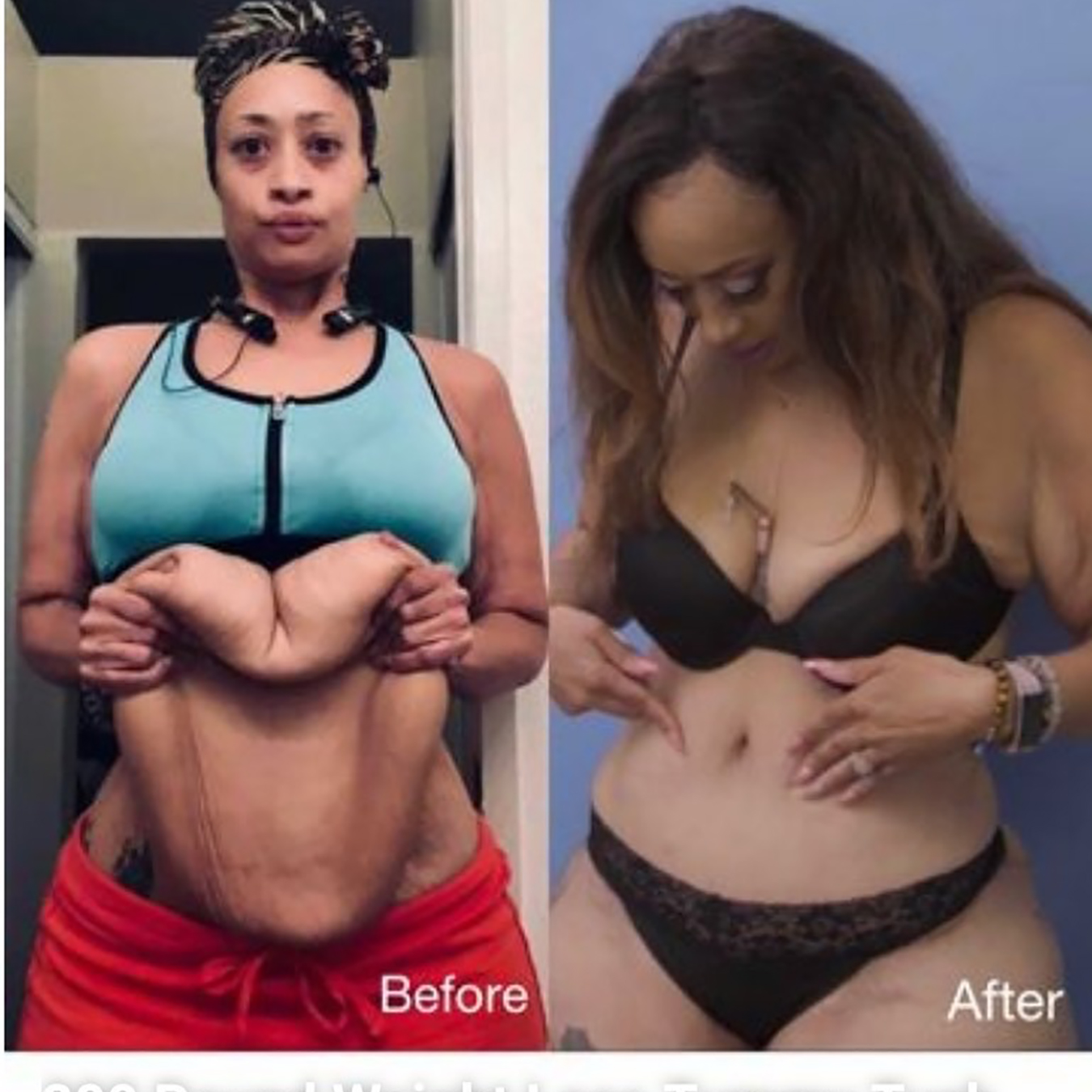 Dr. Cat Plastic Surgery Beverly Hills