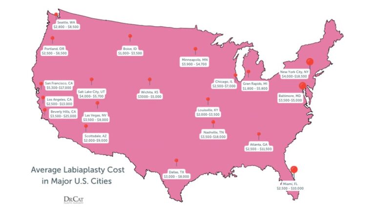 Map showing average labiaplasty costs in major cities across the United States.
