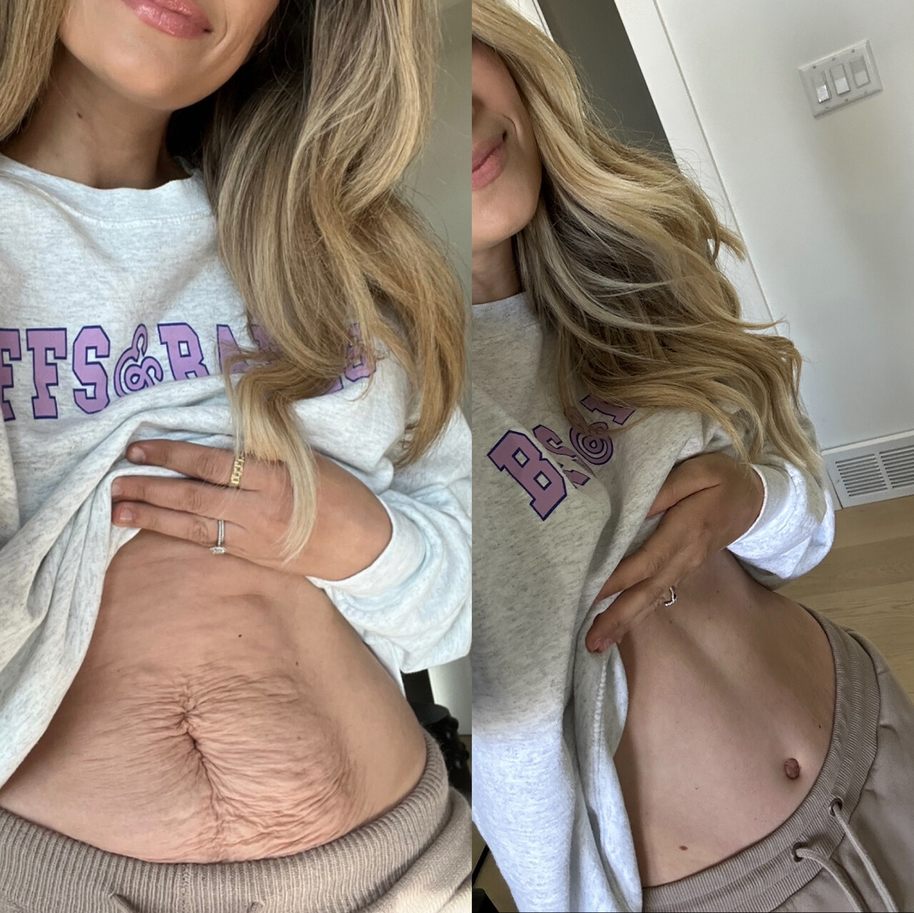 Dr. Cat Plastic Surgery Beverly Hills