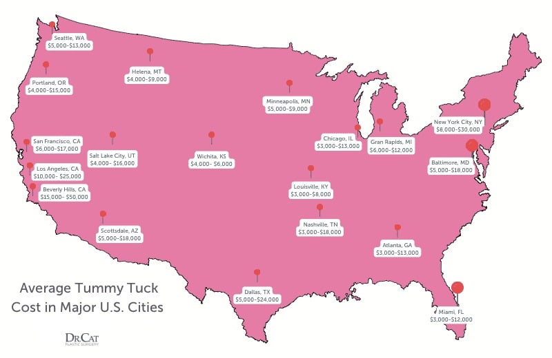 Breakdown of tummy tuck cost factors including surgeon fee, anesthesia, and facility charges