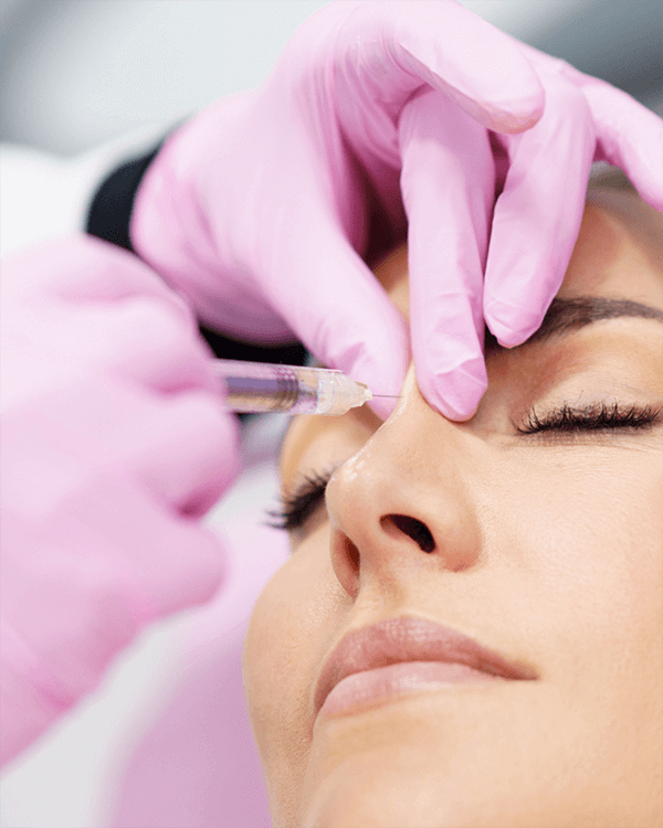 Non surgical rhinoplasty before and after nose reshaping results