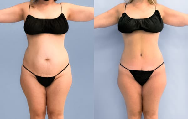 Dr. Cat Plastic Surgery Beverly Hills