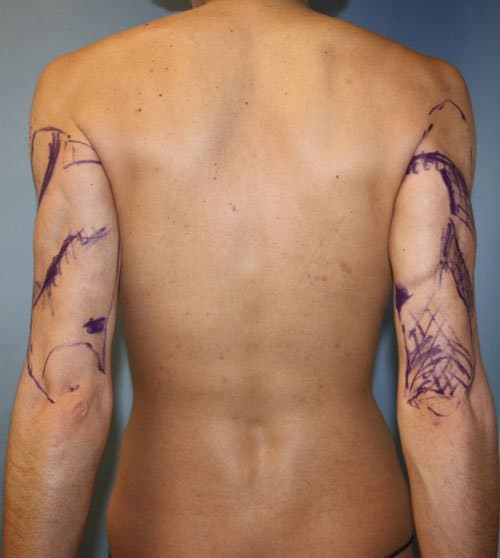 Plastic surgery patient results gallery - Dr. Cat Beverly Hills