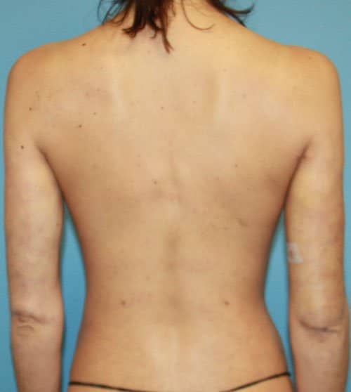 Plastic surgery patient results gallery - Dr. Cat Beverly Hills