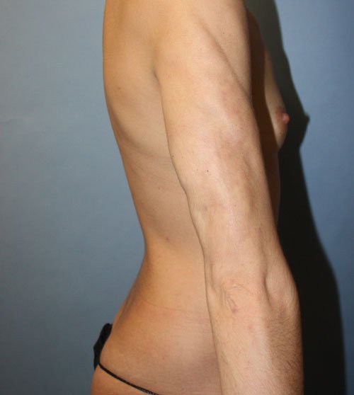 Plastic surgery patient results gallery - Dr. Cat Beverly Hills