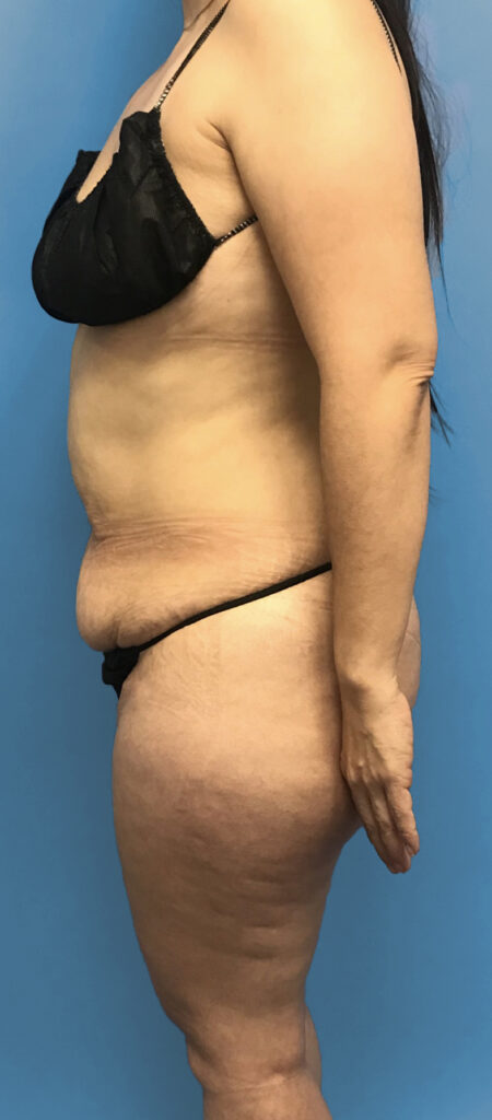 Case TTK-0572 before photo — Dr. Cat, Beverly Hills