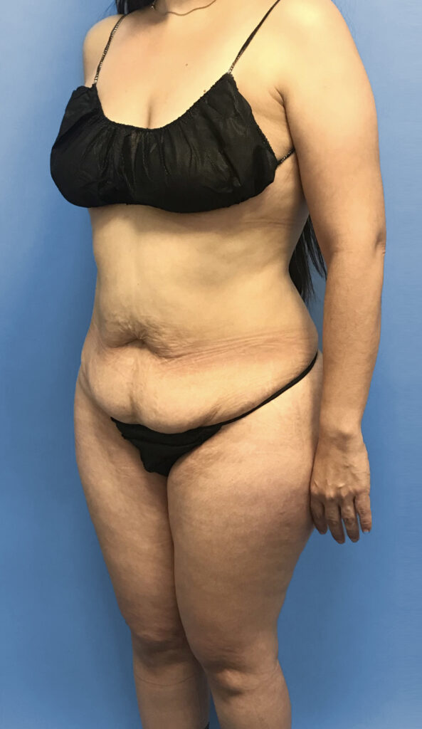 Case TTK-0572 before photo — Dr. Cat, Beverly Hills
