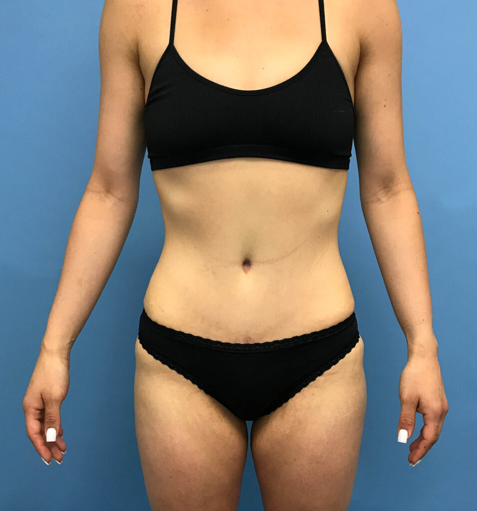 Case TTK-0416 after photo — Dr. Cat, Beverly Hills