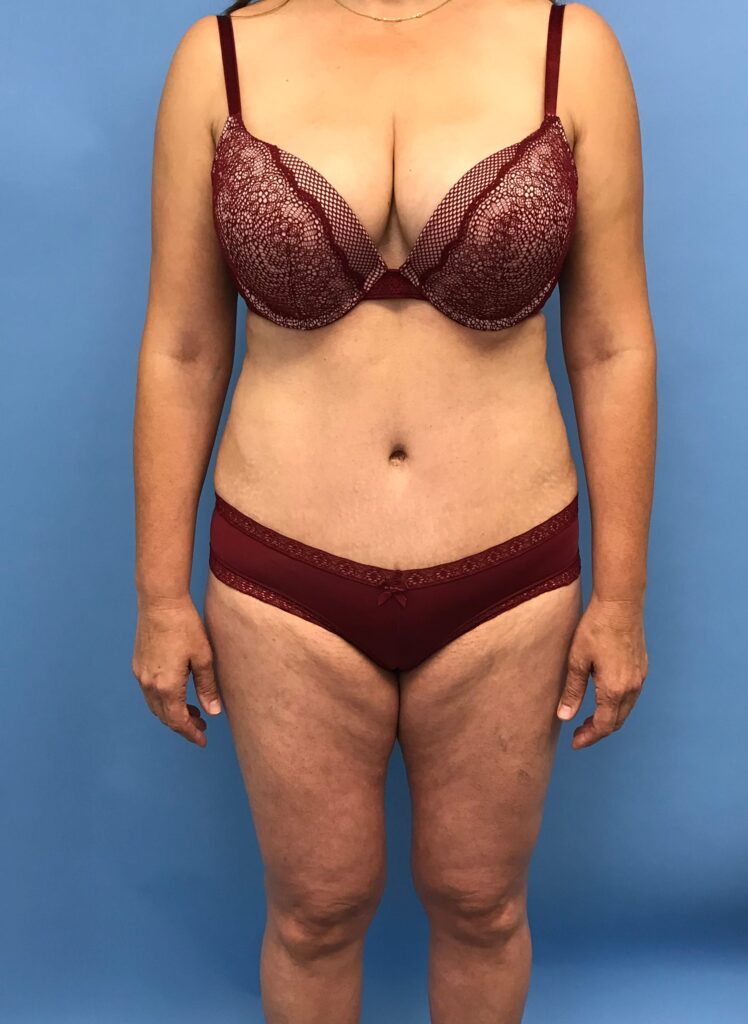 Case TTK-0484 after photo — Dr. Cat, Beverly Hills