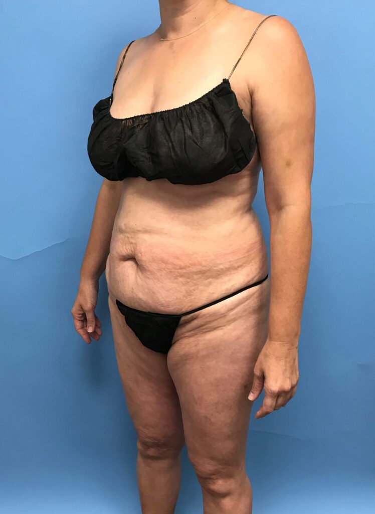 Case TTK-0484 before photo — Dr. Cat, Beverly Hills
