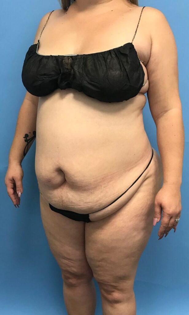 Case TTK-0493 before photo — Dr. Cat, Beverly Hills