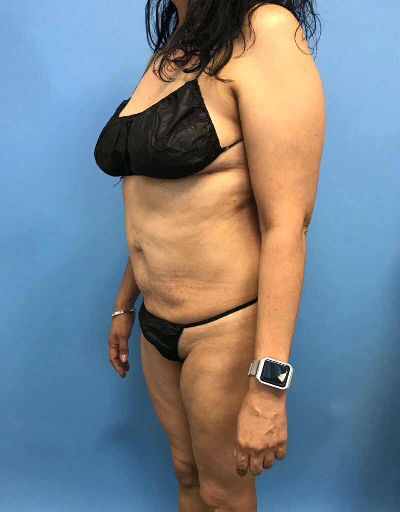 Case RTK-0528 before photo — Dr. Cat, Beverly Hills
