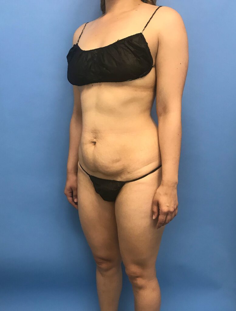 Case TTK-0548 before photo — Dr. Cat, Beverly Hills