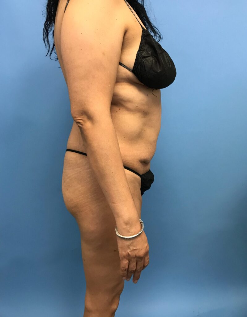 Case RTK-0528 before photo — Dr. Cat, Beverly Hills