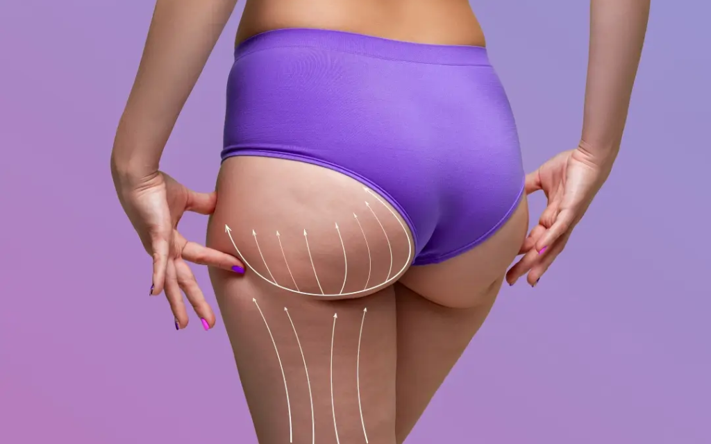 Dr. Cat Plastic Surgery Beverly Hills