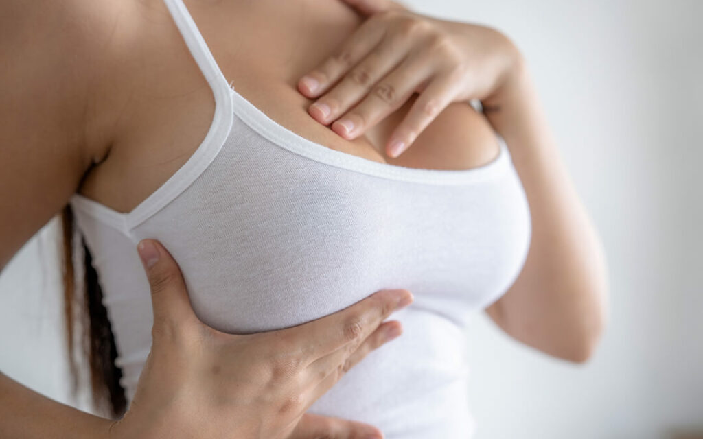Breast Surgery patient results - Dr. Cat Beverly Hills