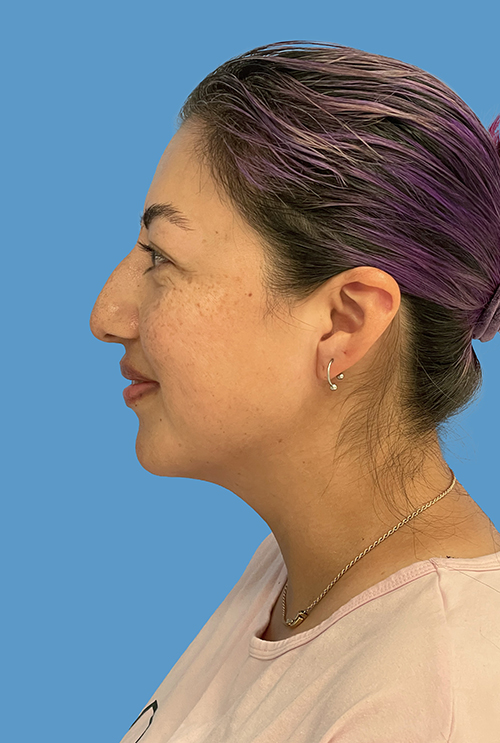 Dr. Cat Plastic Surgery Beverly Hills