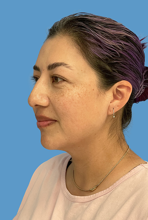 Dr. Cat Plastic Surgery Beverly Hills