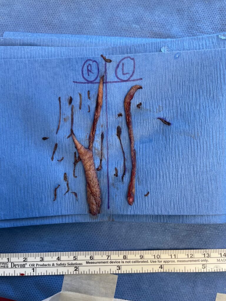 Case LBP-1012 before photo — Dr. Cat, Beverly Hills