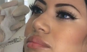 Botox injectable treatment - Dr. Cat Beverly Hills