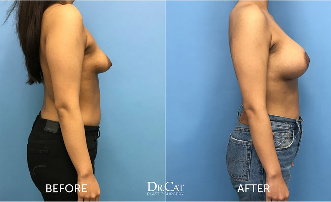 Dr. Cat Plastic Surgery Beverly Hills