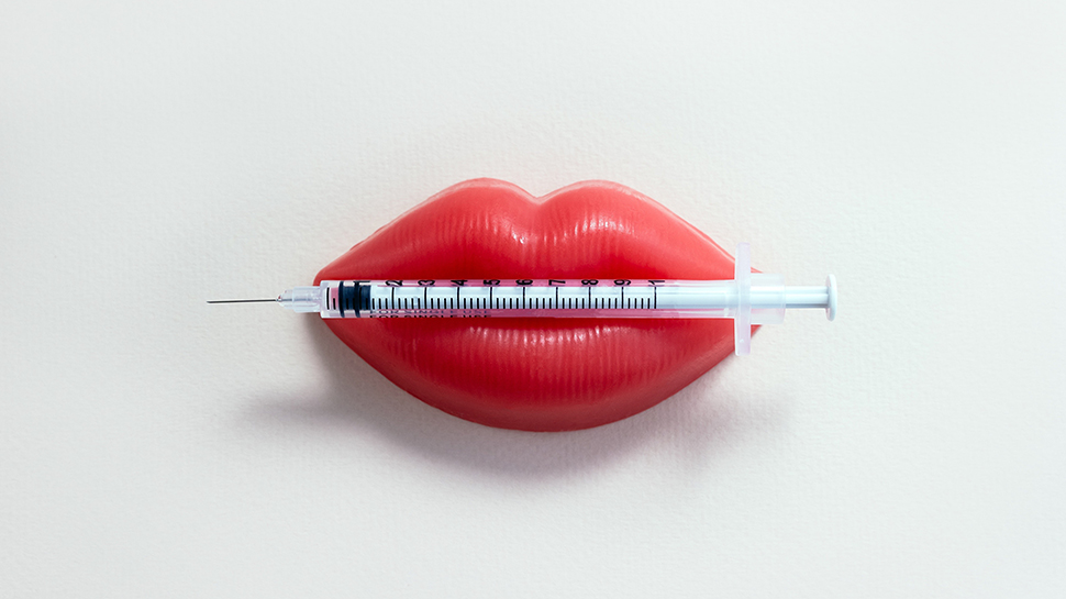 Lip filler treatment and results - Dr. Cat Beverly Hills