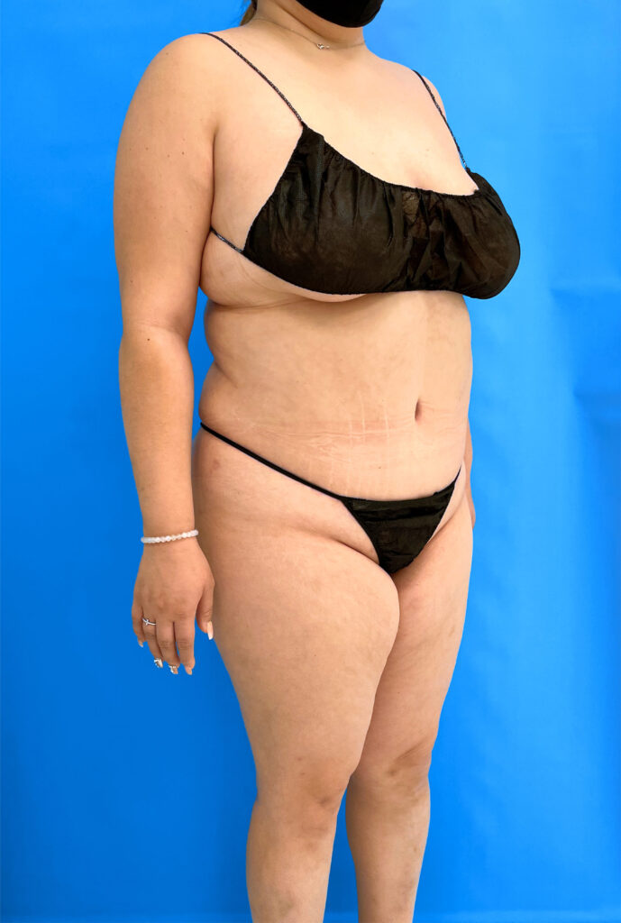 Case RTK-0822 after photo — Dr. Cat, Beverly Hills