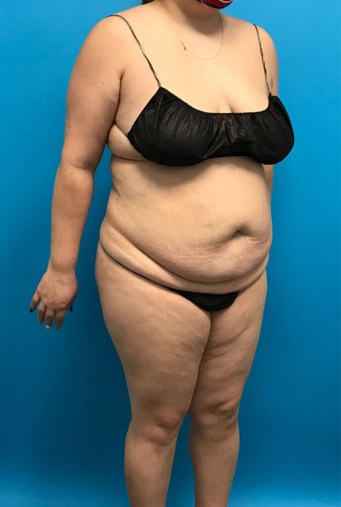 Case RTK-0822 before photo — Dr. Cat, Beverly Hills