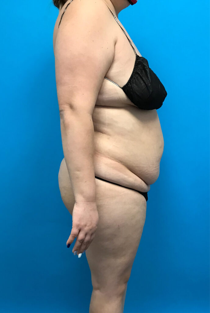 Case RTK-0822 before photo — Dr. Cat, Beverly Hills