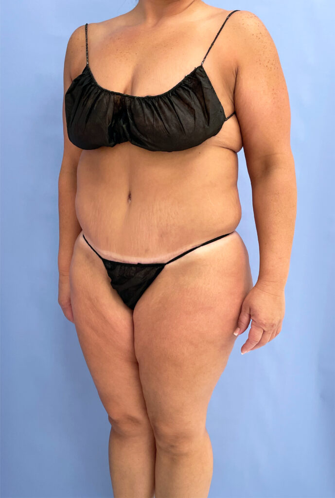 Case TTK-0735 after photo — Dr. Cat, Beverly Hills