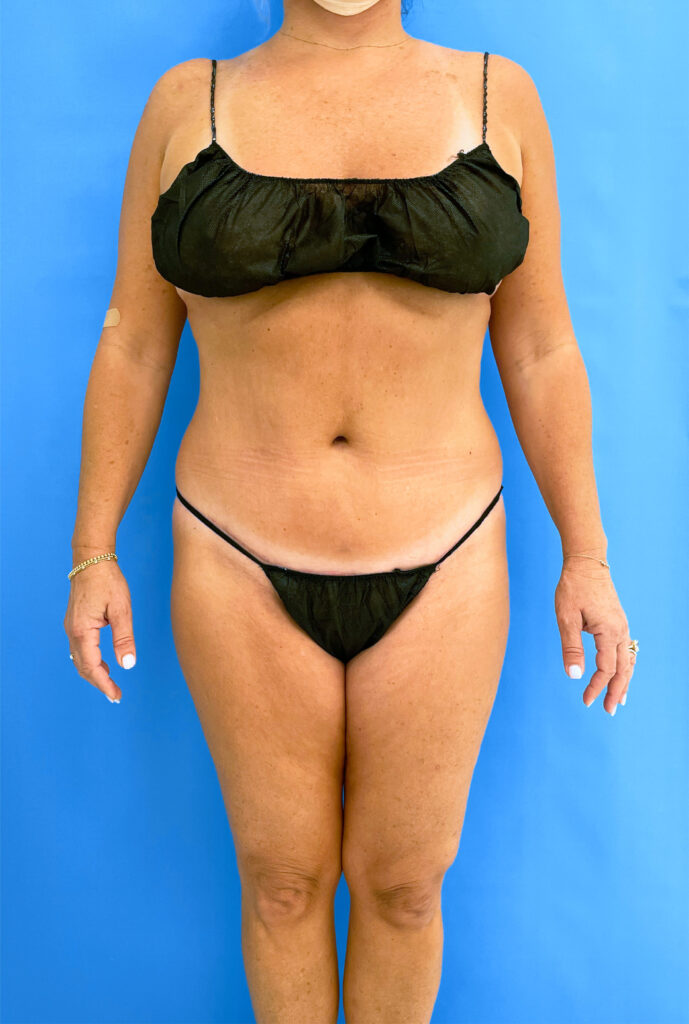Case TTK-0759 after photo — Dr. Cat, Beverly Hills