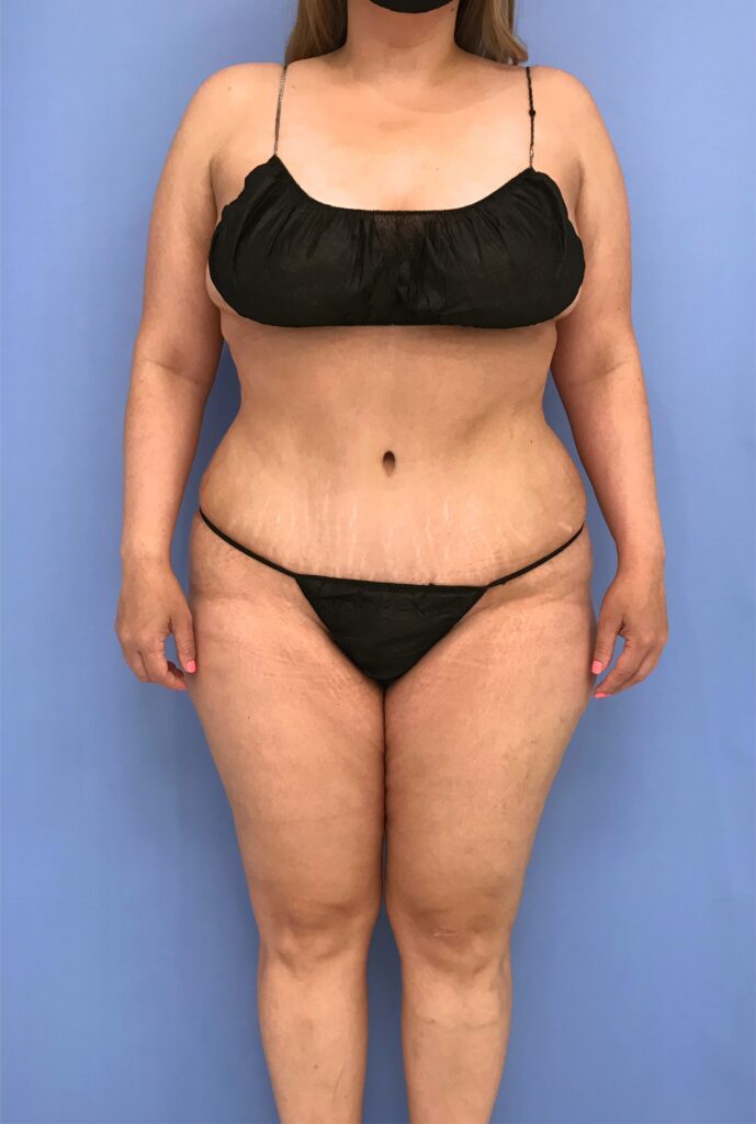 Case TTK-0774 after photo — Dr. Cat, Beverly Hills