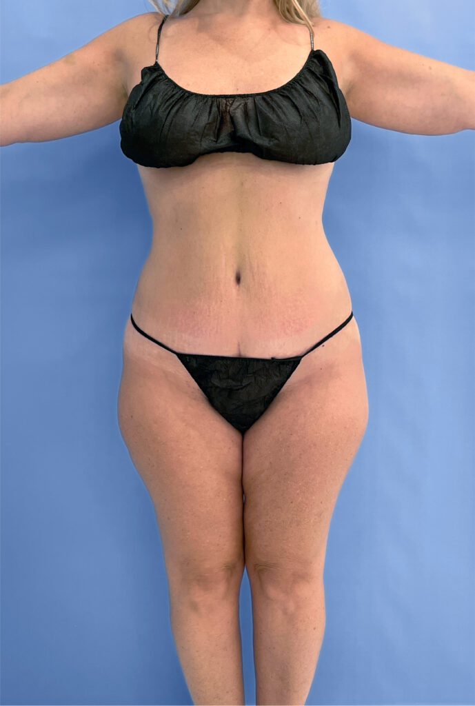 Case TTK-0831 after photo — Dr. Cat, Beverly Hills