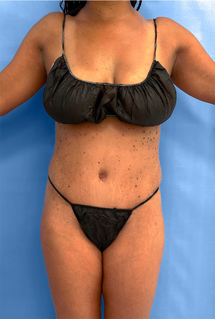 Case TTK-0833 after photo — Dr. Cat, Beverly Hills