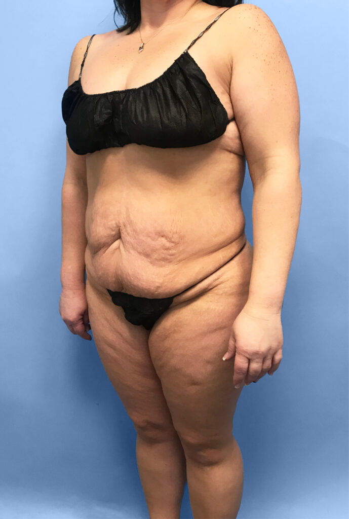 Case TTK-0735 before photo — Dr. Cat, Beverly Hills