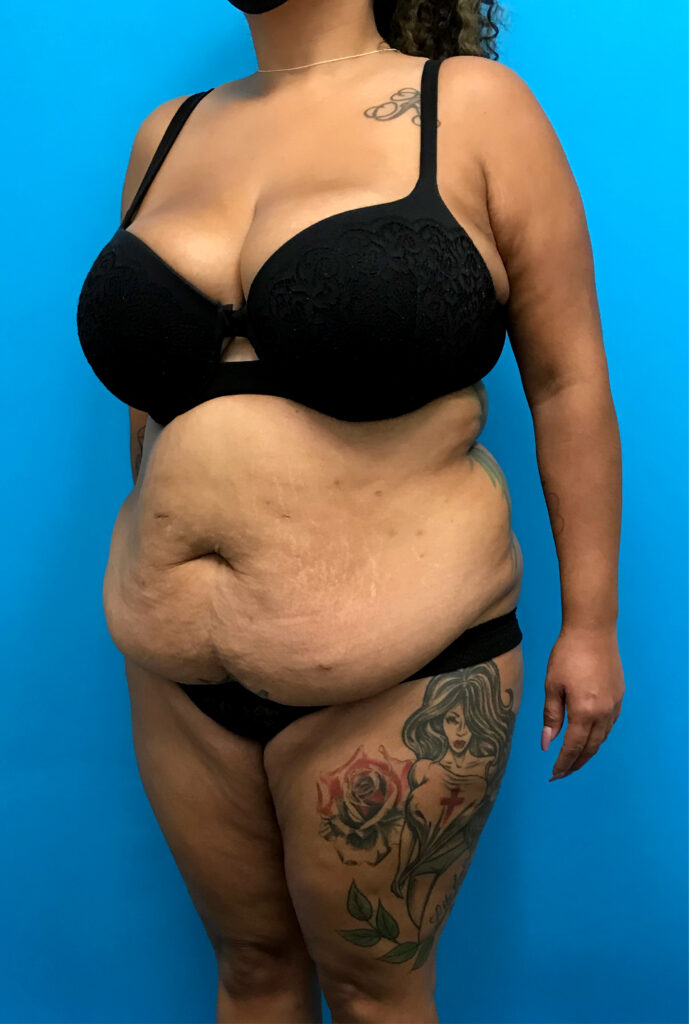 Case TTK-0808 before photo — Dr. Cat, Beverly Hills