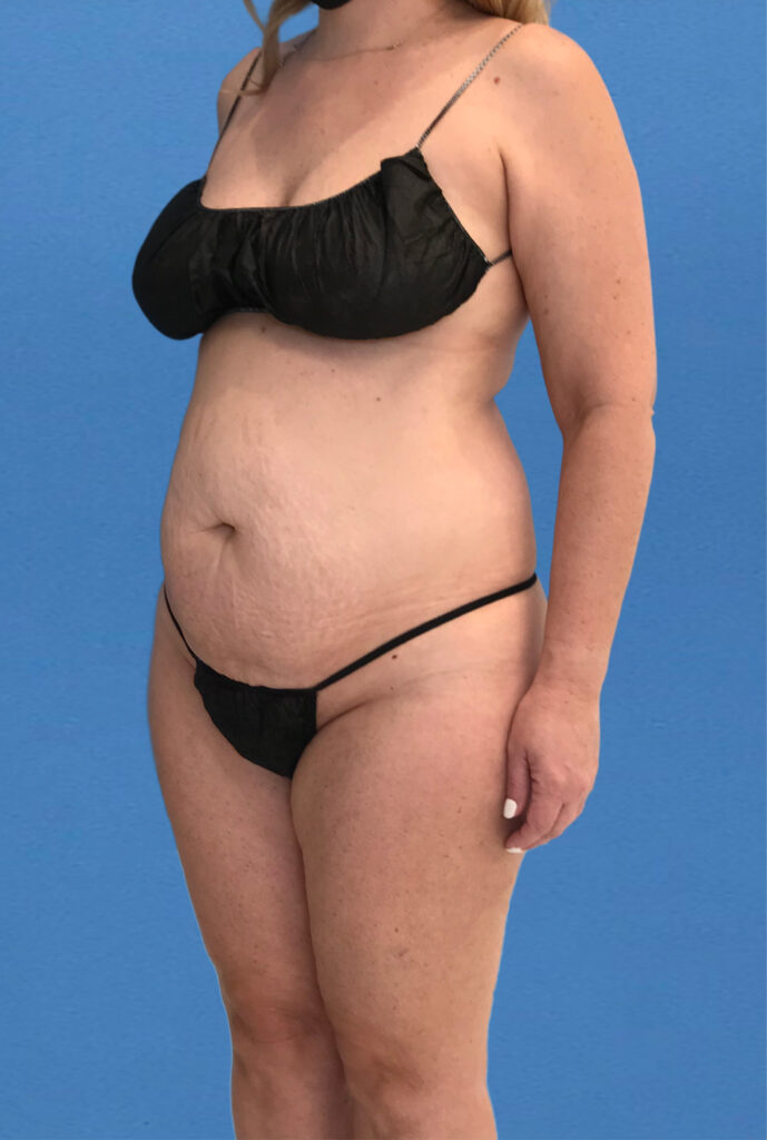 Case TTK-0831 before photo — Dr. Cat, Beverly Hills