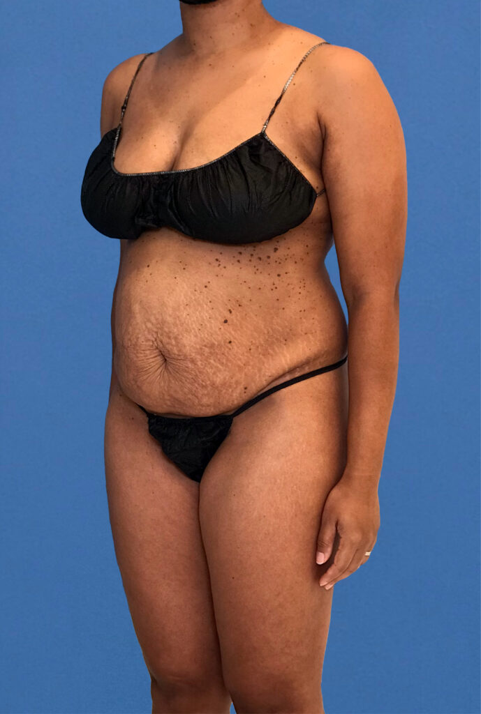 Case TTK-0833 before photo — Dr. Cat, Beverly Hills