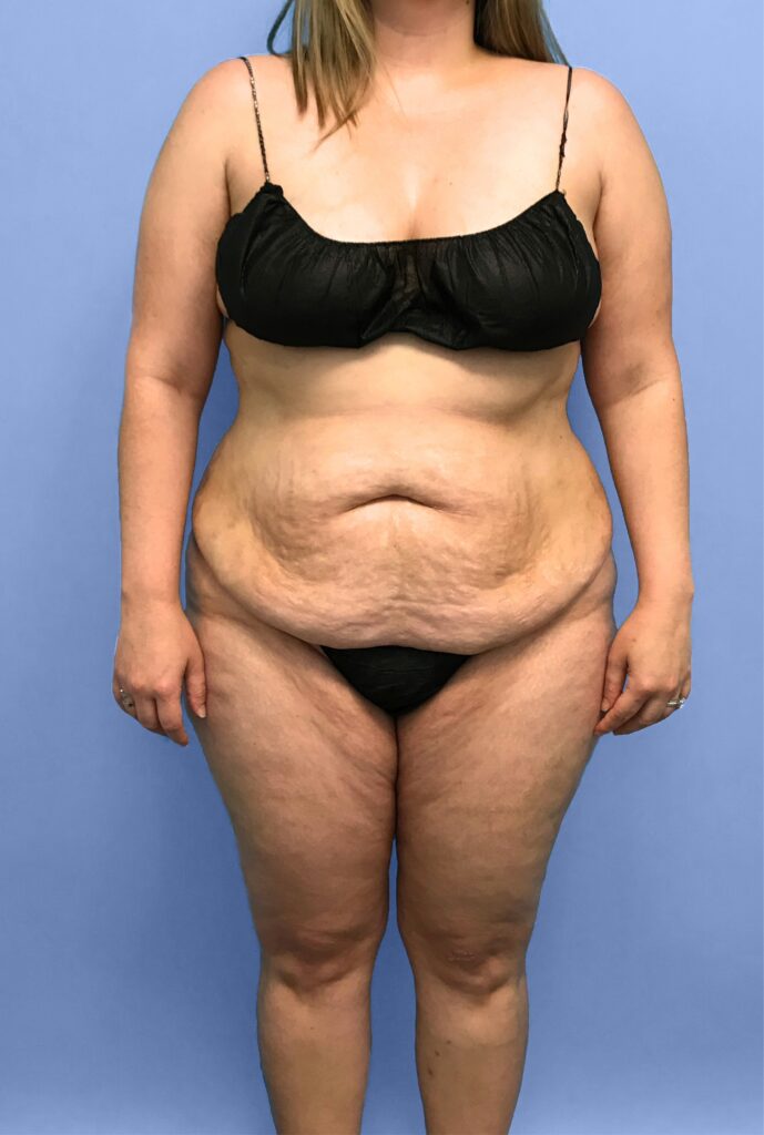Case TTK-0774 before photo — Dr. Cat, Beverly Hills