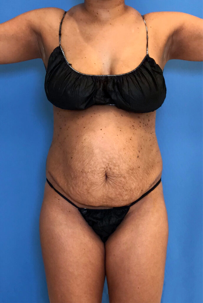 Case TTK-0833 before photo — Dr. Cat, Beverly Hills