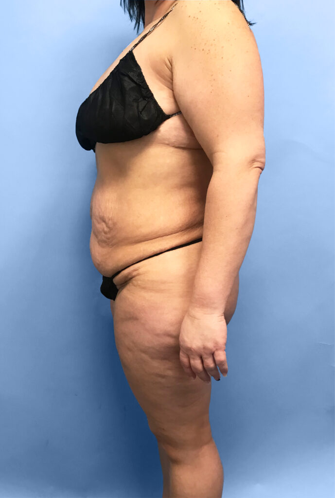 Case TTK-0735 before photo — Dr. Cat, Beverly Hills