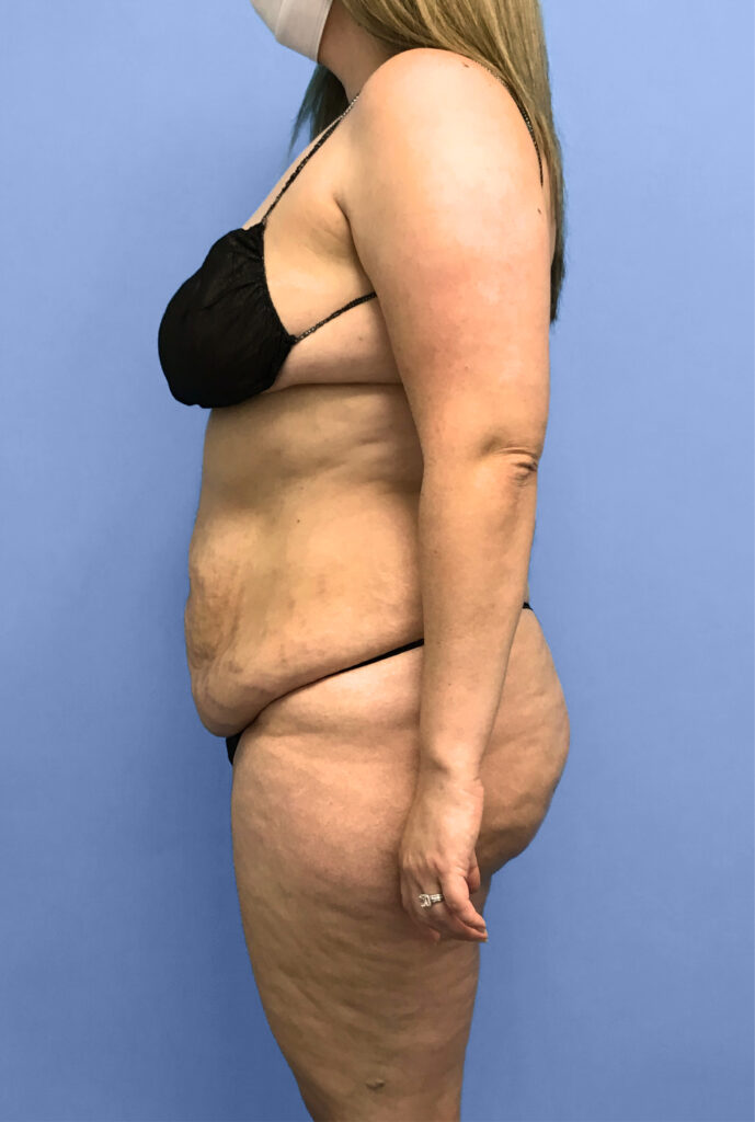 Case TTK-0774 before photo — Dr. Cat, Beverly Hills