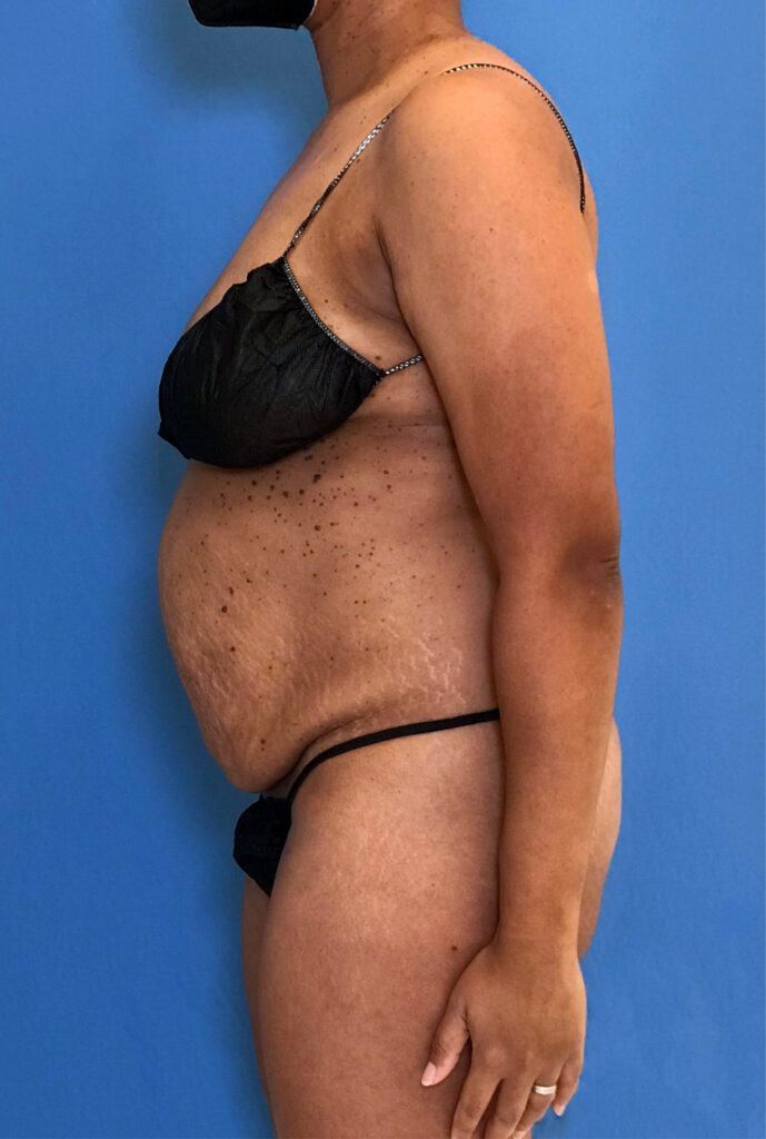 Case TTK-0833 before photo — Dr. Cat, Beverly Hills