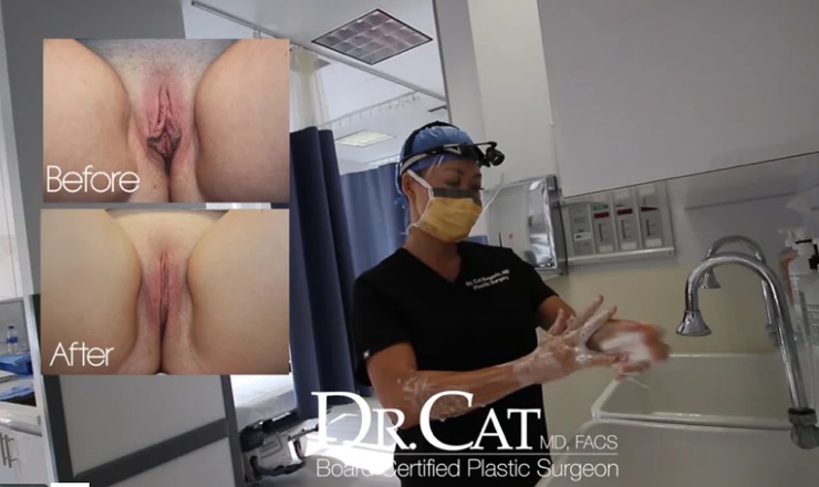 Before-and-after results of designer vagina surgery with Dr. Cat preparing for surgery in a clinical setting.