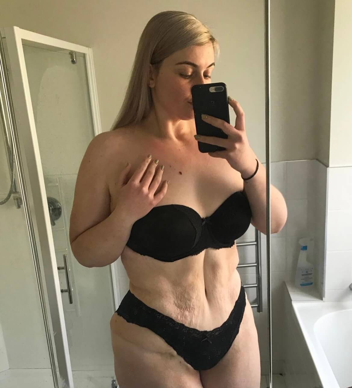 Woman taking a mirror selfie showing aesthetic surgery results on abdomen area.