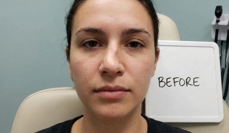 Crooked nose