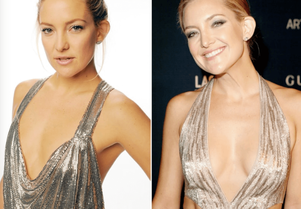 Kate Hudson Breasts Before and After