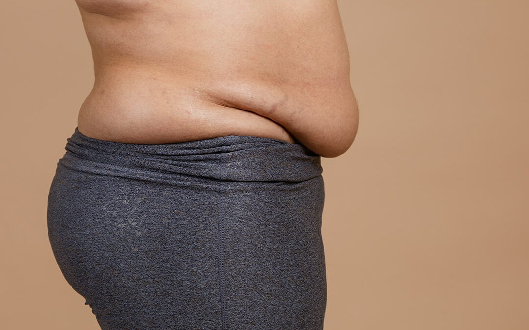 What Causes A Hanging Belly? - Blog