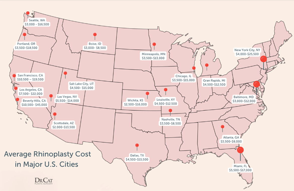 Average rhinoplasty cost comparison across major US cities against nose job cost in Beverly Hills